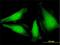 NIMA Related Kinase 6 antibody, H00010783-M01, Novus Biologicals, Immunofluorescence image 