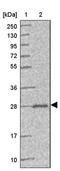 Peroxisomal Biogenesis Factor 11 Beta antibody, PA5-62135, Invitrogen Antibodies, Western Blot image 