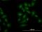 Serine/threonine-protein kinase OSR1 antibody, H00009943-M19, Novus Biologicals, Immunofluorescence image 