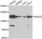 Histone deacetylase 5 antibody, AHP2478, Bio-Rad (formerly AbD Serotec) , Western Blot image 