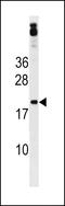 Zinc Finger Protein 740 antibody, LS-C203778, Lifespan Biosciences, Western Blot image 