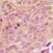 Cyclin Dependent Kinase 20 antibody, abx225097, Abbexa, Western Blot image 