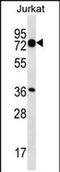 Plastin 1 antibody, PA5-71787, Invitrogen Antibodies, Western Blot image 