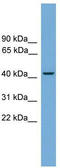 RNA Binding Fox-1 Homolog 2 antibody, TA329968, Origene, Western Blot image 