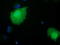 RB Binding Protein 9, Serine Hydrolase antibody, TA501676, Origene, Immunofluorescence image 