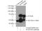 Melanoma-associated antigen D2 antibody, 15252-1-AP, Proteintech Group, Immunoprecipitation image 