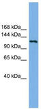 Eukaryotic Translation Initiation Factor 4E Nuclear Import Factor 1 antibody, TA344815, Origene, Western Blot image 