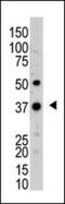 Ubiquitin C-Terminal Hydrolase L5 antibody, GTX01069, GeneTex, Western Blot image 