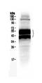 Plasminogen Activator, Urokinase Receptor antibody, A00993-1, Boster Biological Technology, Western Blot image 