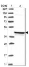 Decaprenyl Diphosphate Synthase Subunit 2 antibody, PA5-56230, Invitrogen Antibodies, Western Blot image 