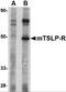 Cytokine receptor-like factor 2 antibody, 4209, ProSci, Western Blot image 