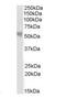 Protein Phosphatase 2 Regulatory Subunit B'Beta antibody, orb18330, Biorbyt, Western Blot image 