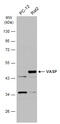 Vasodilator Stimulated Phosphoprotein antibody, GTX132983, GeneTex, Western Blot image 