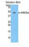 Alpha Fetoprotein antibody, LS-C292764, Lifespan Biosciences, Western Blot image 