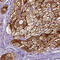 ELOVL Fatty Acid Elongase 3 antibody, HPA036236, Atlas Antibodies, Immunohistochemistry frozen image 