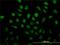DNA repair protein RAD51 homolog 3 antibody, H00005889-M01, Novus Biologicals, Immunocytochemistry image 