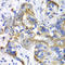 60S ribosomal protein L9 antibody, A6406, ABclonal Technology, Immunohistochemistry paraffin image 