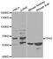 Tumor Protein P63 antibody, LS-C331932, Lifespan Biosciences, Western Blot image 