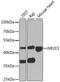 Photoreceptor-specific nuclear receptor antibody, STJ27990, St John
