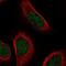 Zinc Finger Protein 628 antibody, NBP1-92638, Novus Biologicals, Immunofluorescence image 