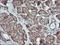 RAB21, Member RAS Oncogene Family antibody, LS-C174495, Lifespan Biosciences, Immunohistochemistry paraffin image 