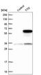TELO2 Interacting Protein 2 antibody, HPA029823, Atlas Antibodies, Western Blot image 