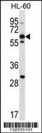 Neuronal Pentraxin Receptor antibody, 56-878, ProSci, Western Blot image 
