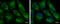 Mitochondrial fission 1 protein antibody, GTX630992, GeneTex, Immunocytochemistry image 