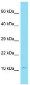 GON7 Subunit Of KEOPS Complex antibody, TA333612, Origene, Western Blot image 