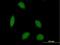 Calcium Responsive Transcription Factor antibody, H00079800-B01P, Novus Biologicals, Immunocytochemistry image 