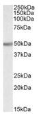 UDP-glucuronosyltransferase 2B2 antibody, AP23764PU-N, Origene, Western Blot image 