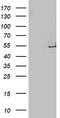 Lipoprotein Lipase antibody, CF503789, Origene, Western Blot image 