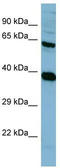 Serine/threonine-protein phosphatase 2A 65 kDa regulatory subunit A alpha isoform antibody, TA344605, Origene, Western Blot image 