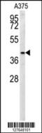 Solute Carrier Family 35 Member B2 antibody, 55-017, ProSci, Western Blot image 