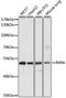 Retinoic Acid Receptor Alpha antibody, A0370, ABclonal Technology, Western Blot image 