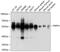 Pre-MRNA Processing Factor 4 antibody, GTX66476, GeneTex, Western Blot image 