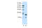 Heme oxygenase 2 antibody, 31-129, ProSci, Western Blot image 