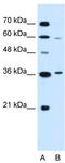 Presenilin Associated Rhomboid Like antibody, TA336006, Origene, Western Blot image 