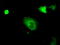 PKG1 antibody, LS-C115236, Lifespan Biosciences, Immunofluorescence image 