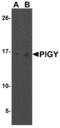 Phosphatidylinositol Glycan Anchor Biosynthesis Class Y antibody, NBP1-77340, Novus Biologicals, Western Blot image 