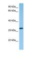 Capping Actin Protein Of Muscle Z-Line Subunit Beta antibody, orb330976, Biorbyt, Western Blot image 