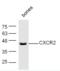 C-X-C Motif Chemokine Receptor 2 antibody, orb10488, Biorbyt, Western Blot image 