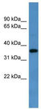 G Protein-Coupled Receptor 88 antibody, TA329464, Origene, Western Blot image 