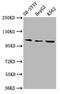 Unc-51 Like Autophagy Activating Kinase 2 antibody, CSB-PA811629LA01HU, Cusabio, Western Blot image 