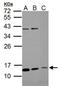 Rhophilin Associated Tail Protein 1B antibody, GTX112010, GeneTex, Western Blot image 