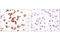 EPH Receptor A2 antibody, 6997P, Cell Signaling Technology, Immunohistochemistry paraffin image 