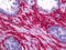 Collagen Type I Alpha 1 Chain antibody, 70-028, ProSci, Immunohistochemistry paraffin image 