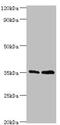 General Transcription Factor IIB antibody, A54471-100, Epigentek, Western Blot image 