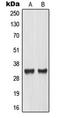 Max-like protein X antibody, LS-C352918, Lifespan Biosciences, Western Blot image 