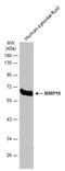 Matrix Metallopeptidase 19 antibody, NBP2-17312, Novus Biologicals, Western Blot image 